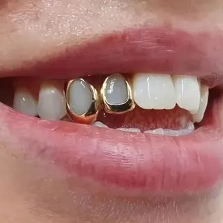 Hollow Heart Zirconia Double Grillz - 18K Gold Plated Copper Hip-Hop Tooth Jewelry, Rhinestone Teeth Decor for Party & TikTok